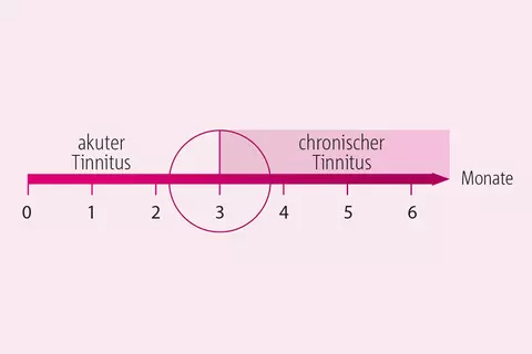 Zeitliche Abgrenzung: Ab 3 Monaten spricht man von einem chronischem Tinnitus.